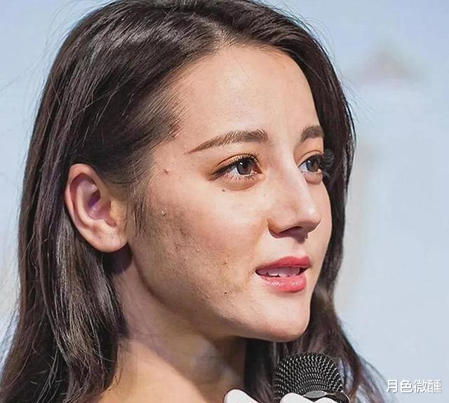 迪丽热巴 迪丽热巴满脸痘痘，女神落入凡间，网友调侃她只能活在精修图里