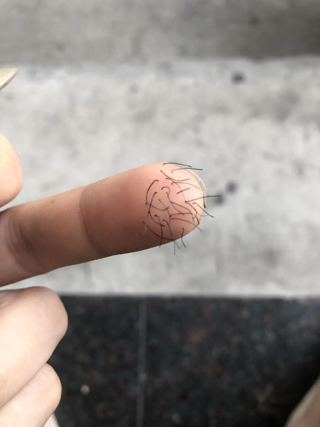 去河里游泳回来，手指突然长了这几根毛，这是怎么了？