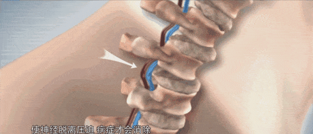 医生|久病不愈的骨病患者都不知道腰椎病其实要治的是这里!