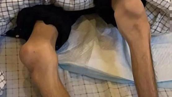 19岁男孩游泳后住ICU，花60多万却仍全身抽搐，和游泳馆的水有关吗？