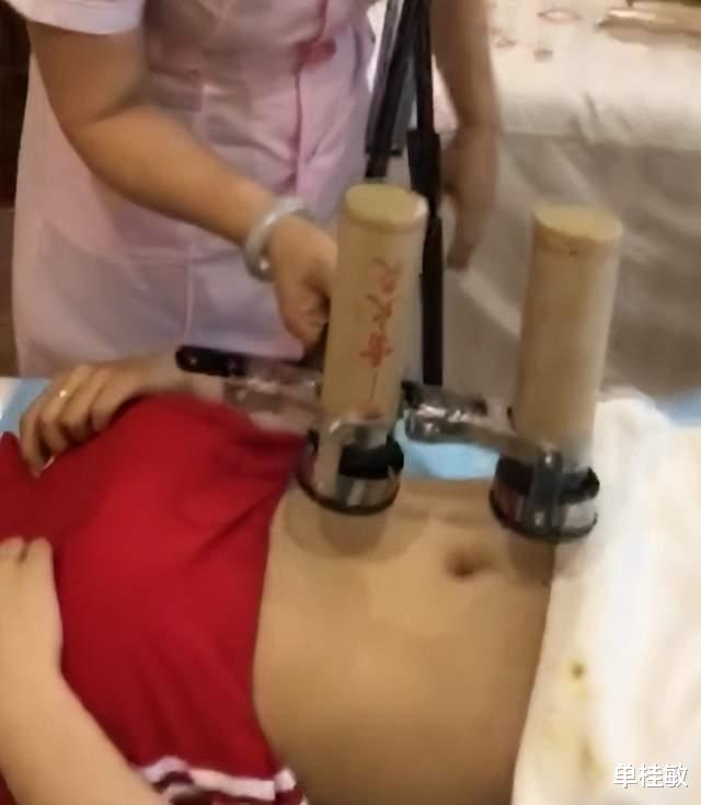 艾灸|用艾灸治疗肝硬化