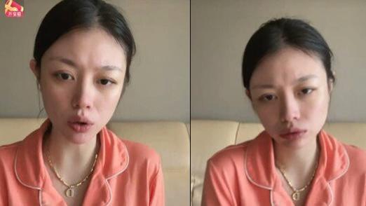 汪峰|汪峰前妻自曝欠60W外债，目光呆滞手臂抓痕明显，精神状态引担忧