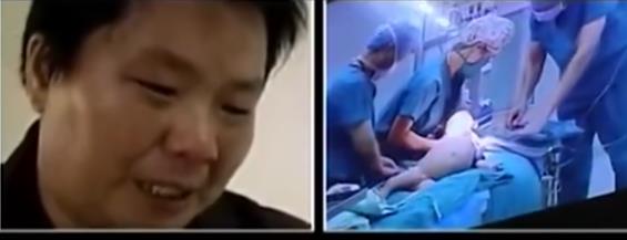 河南1岁半女童疑似怀孕,检查后在腹中发现胎儿,手术现场惊呆医生