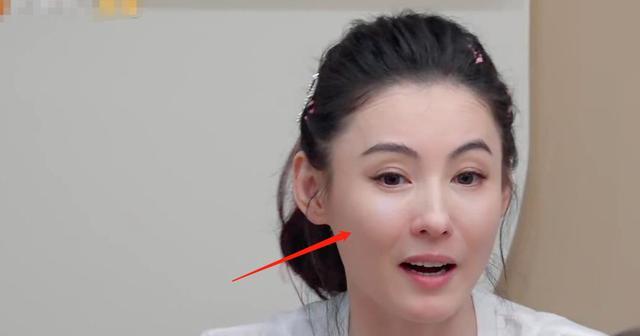 殷桃|看似光滑水嫩、实则脸已僵硬,这些酷爱打针的女星,都遭到了反噬