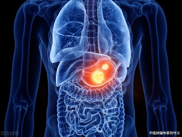 抗癌|抗癌中药——斑蝥，功效破血逐瘀、攻毒蚀疮、散结消癥