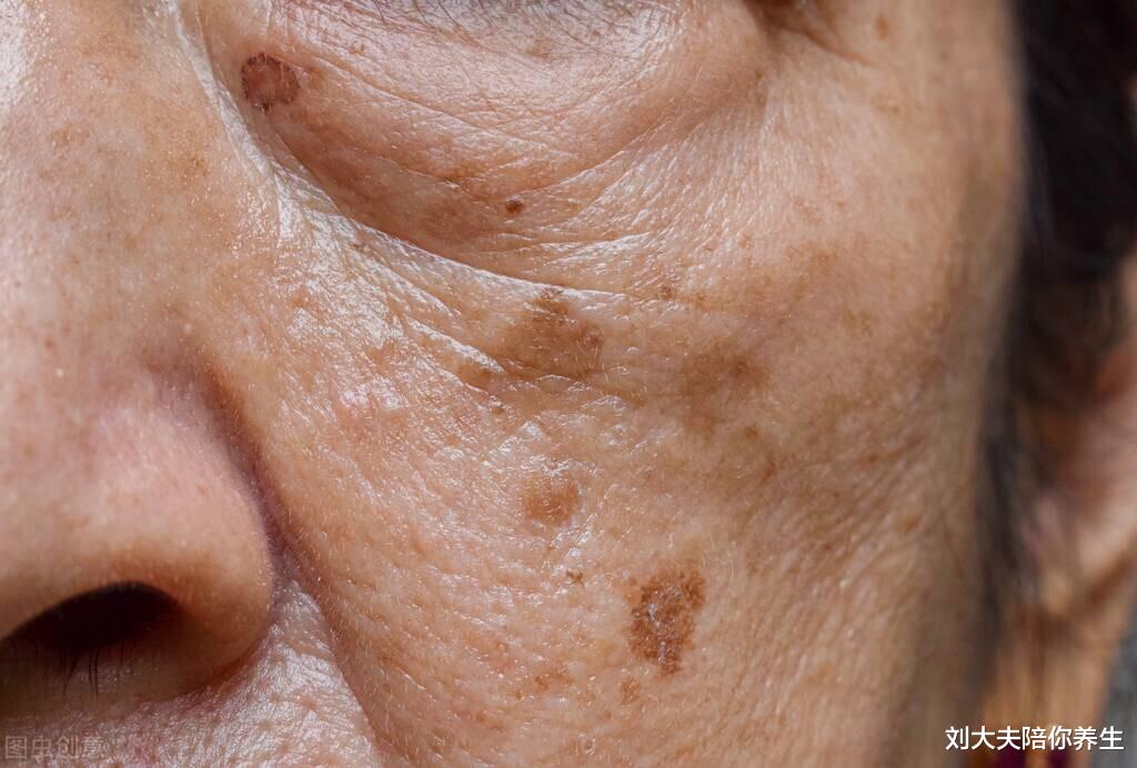 痛风|更年期头晕、腰疼、掉发？6种食物补血、滋阴、安神，改善更年期