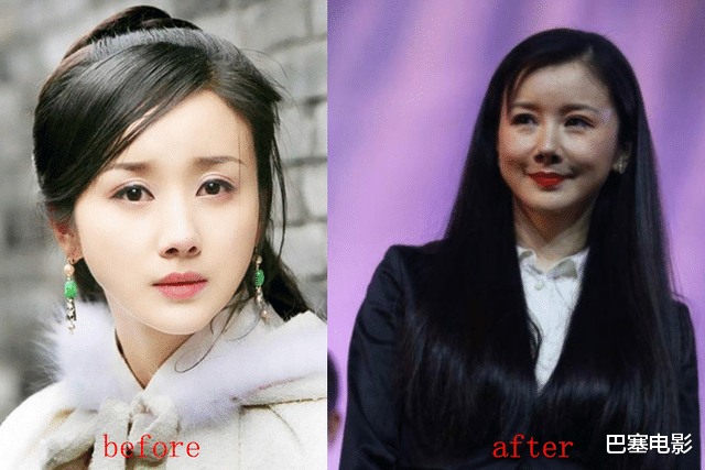 童瑶|明星换脸好惊人,面目全非不同命,有人爆红上位,有人不如从前