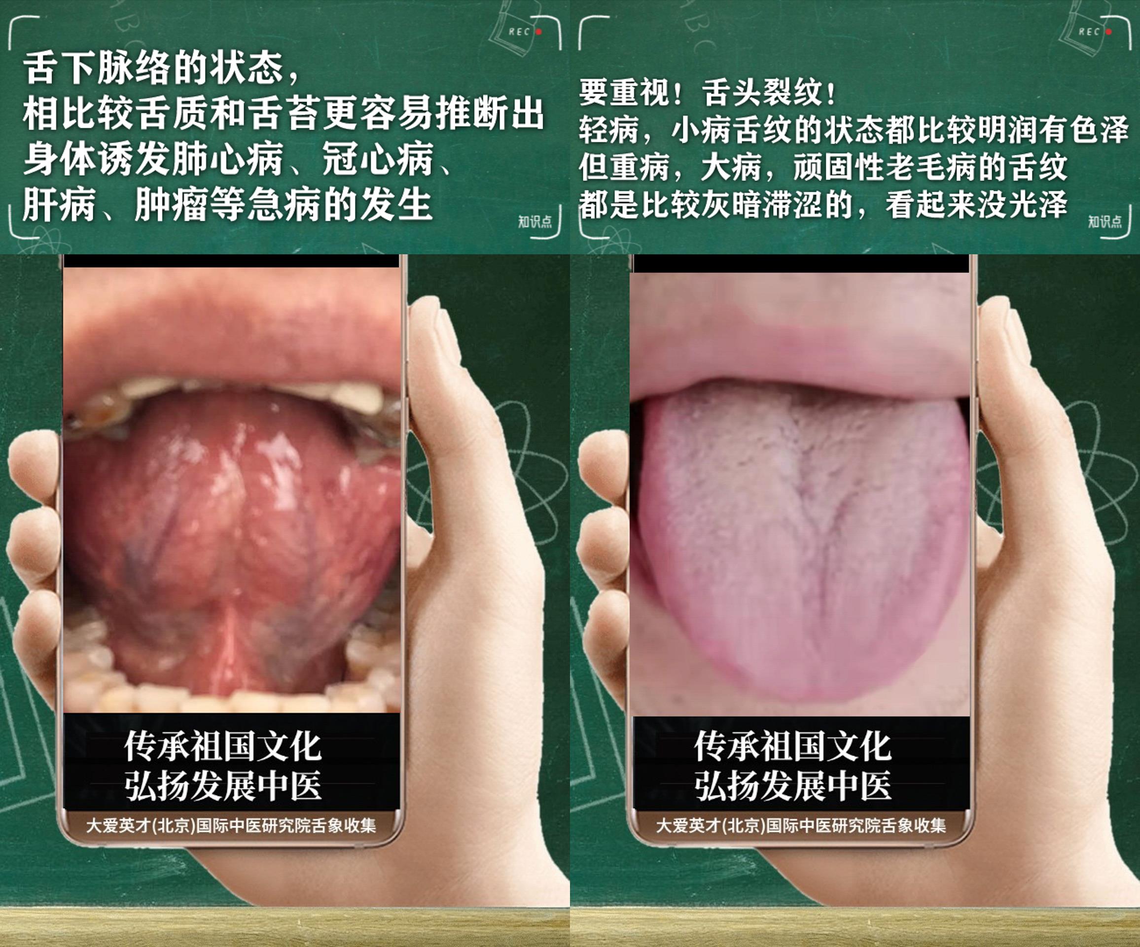 |中医解析:工作效率低下,痰火扰心,四肢乏力,气阴不和