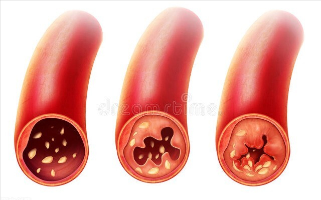红枣|长期吃降血脂药，伤肝伤肾？什么时候吃最好？注意5点更安全有效