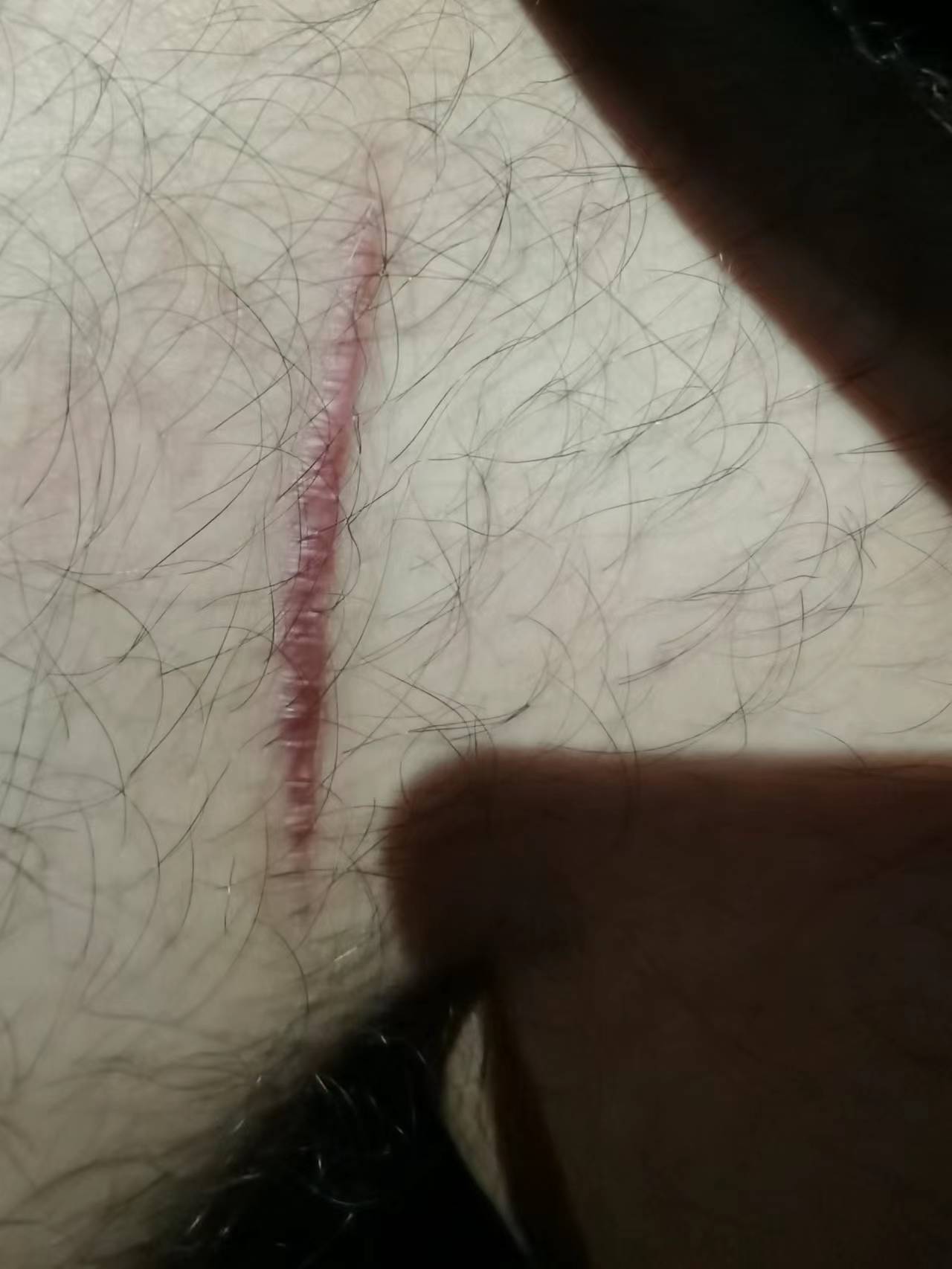 申通快递小哥撞伤人却故意失联,快递点存在消防隐患谁能承担?