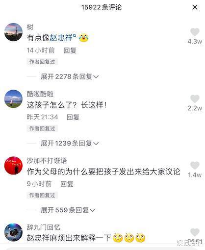 赵忠祥|四岁女孩酷似赵忠祥，被曝光后遭全网恶意嘲讽，孩子只是生病了！