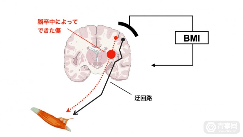 脑机接口|日本BMI脑机接口公司LIFESCAPES获7.2亿日元融资