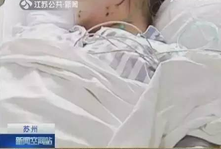 中药|女子体内取出468颗结石:惜命的最好方式不是养生,而是好好吃饭