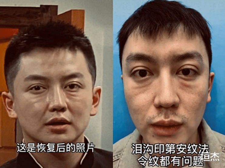 整容|网红金大威：哭诉整容失败史，小鲜肉变沧桑大叔，到底是谁害了他