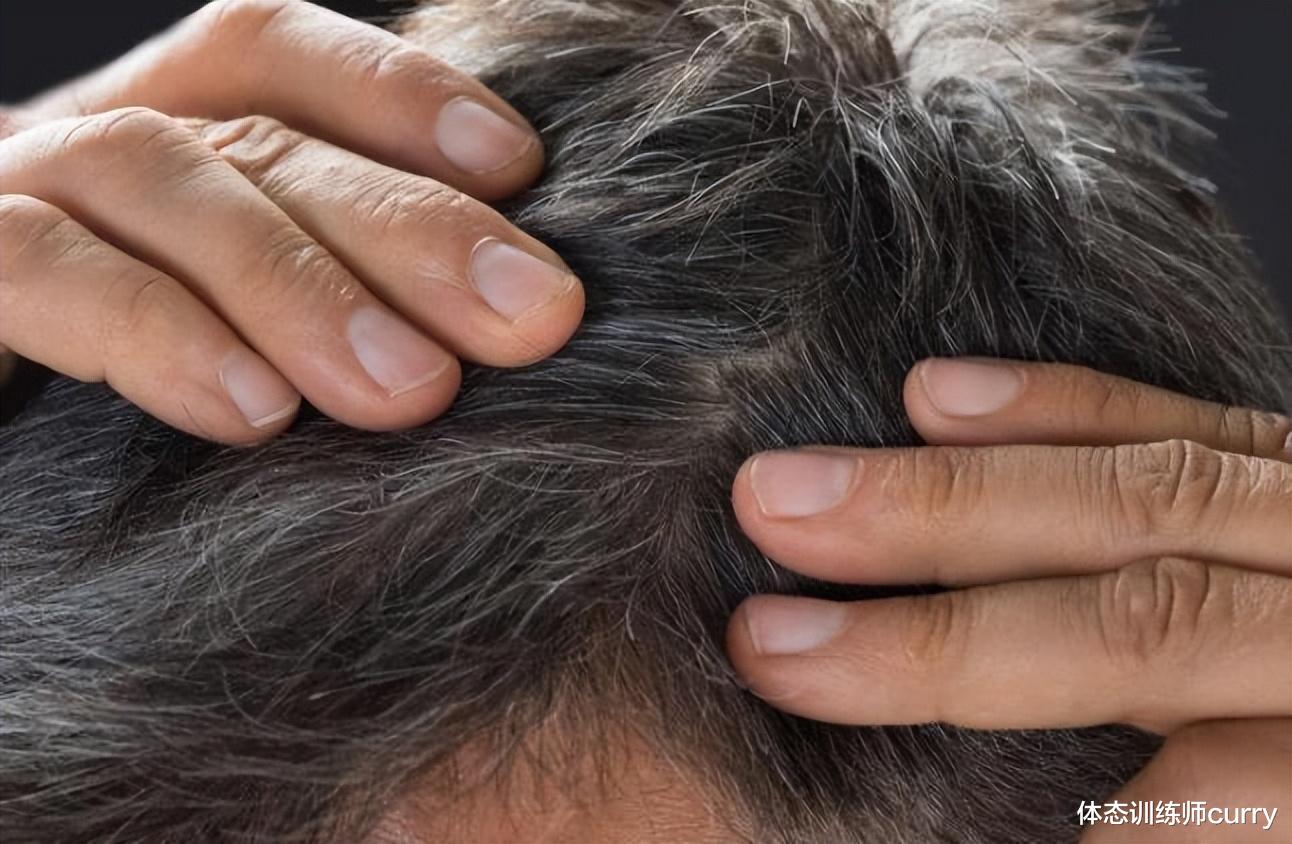 大蒜|白发长在哪,病就在哪出?长在前额、两鬓、后脑勺,分别代表啥?