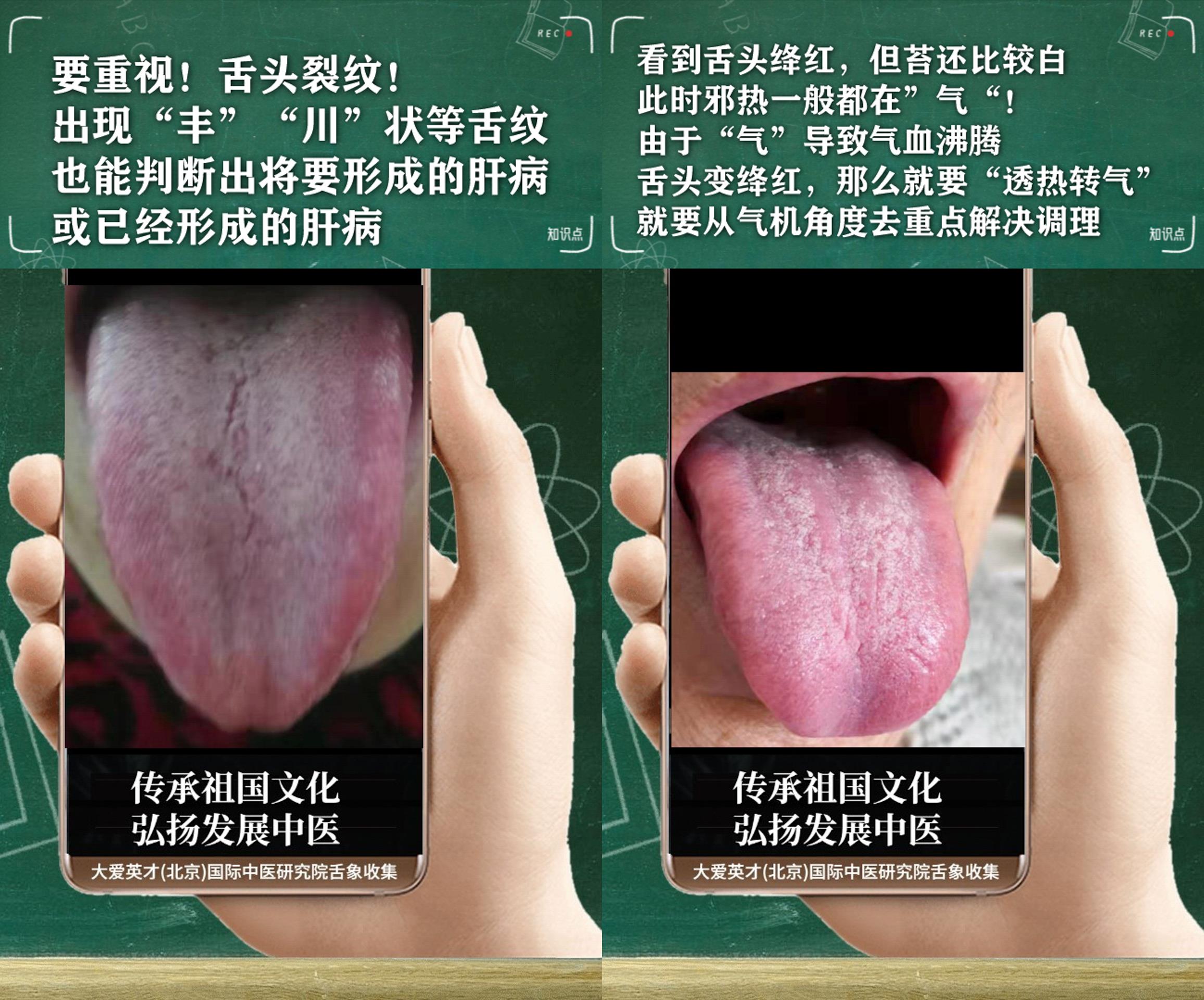 疾病|中医病症：很沮丧，身困，水湿上泛，时好时差非常崩溃