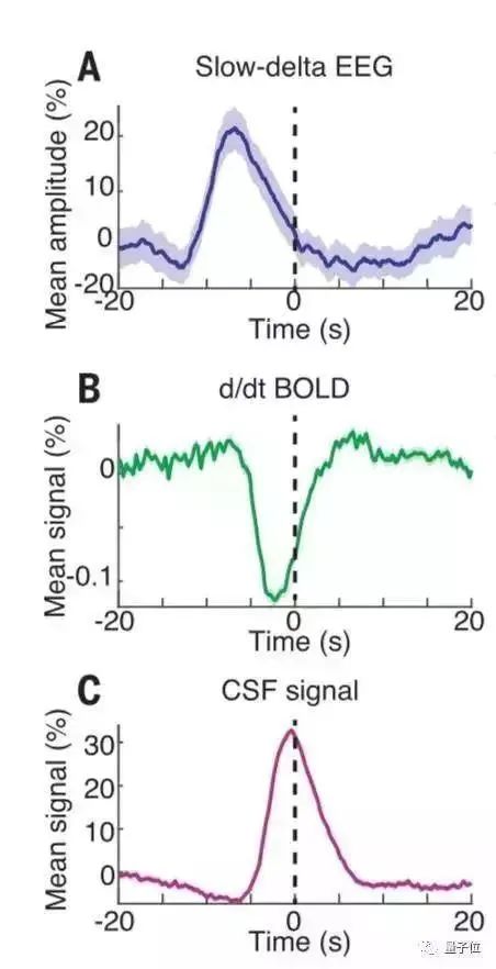 科普|科学家首次拍下人类睡觉时大脑的清洗全过程,熬夜变傻有科学依据!