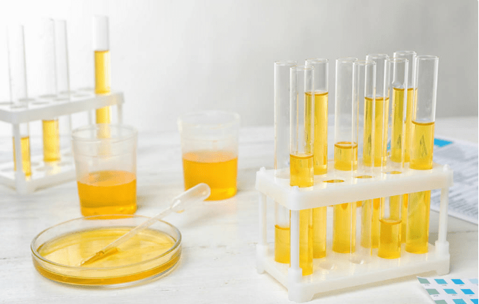 尿蛋白|盘点不同类型尿蛋白用药,肾内医生讲得很全面,值得收藏