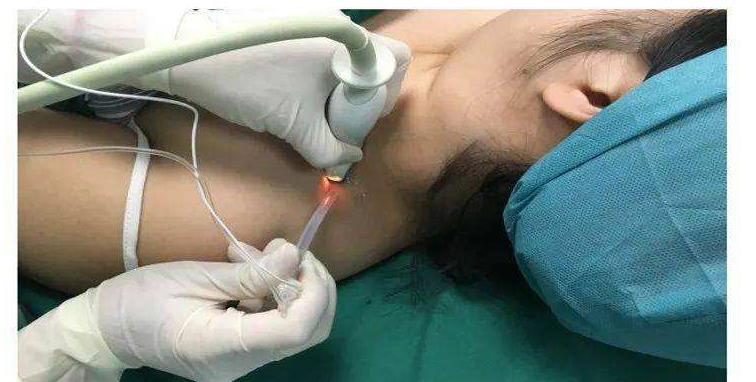 医生|掀起“盖头”,她泪流满面,而医生痛彻心扉