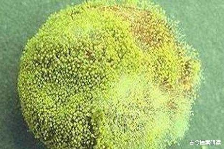 甲状腺|央视曝光过的“毒筷子”,至今仍有很多家庭使用,快看看你家有没有