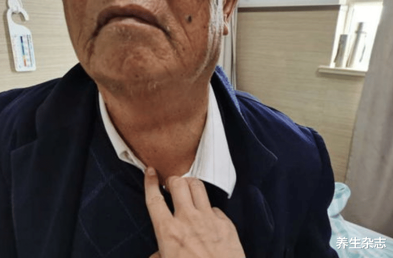 后遗症|甲状腺结节“盯上”中年人：40岁后出现“1痒1麻”，结节可能在接近