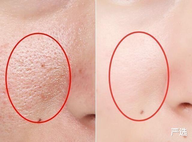 护肤 那些正慢慢毁掉您皮肤的护肤谣言，北大医生：乱用真的会毁容！