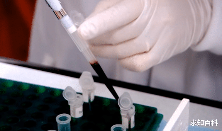 美国生物研究:构成身体的一半是“非人类”细胞,你只算43%的人