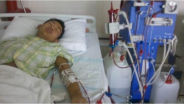 尿毒症|尿毒症是怎么患上的？医生提醒：生活中，建议远离3个坏习惯