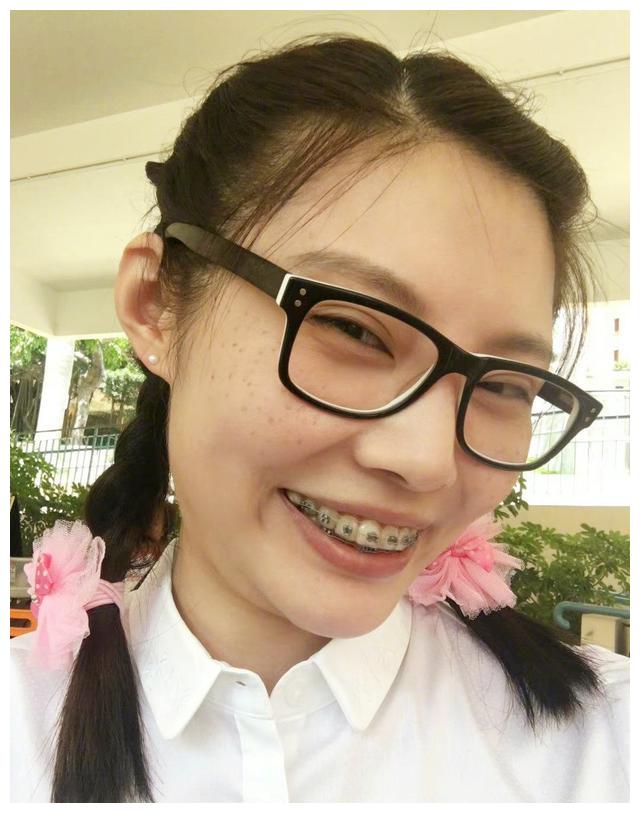 徐冬冬|徐冬冬曝光大量丑照自黑！一脸雀斑箍牙套，“大嫂”形象荡然无存