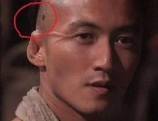 明星|无子宫、站不直、对口水过敏,这些明星的隐疾,真是千奇百怪