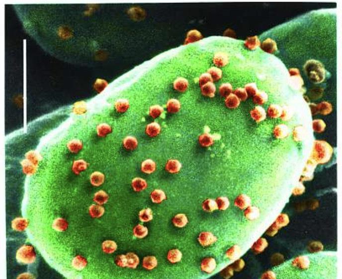 科学家发现能吃掉并消化病毒的微生物!病毒的终极天敌要来了?