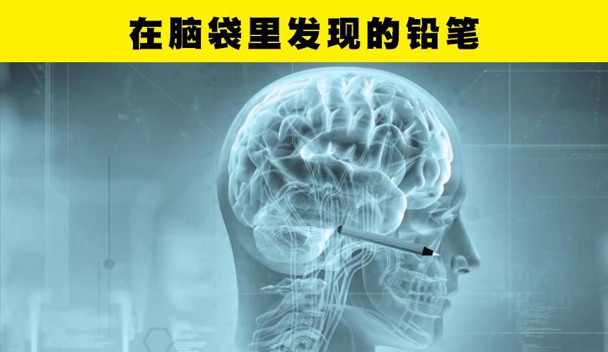 在人类的身体里,被找到的7个令人意外的事物