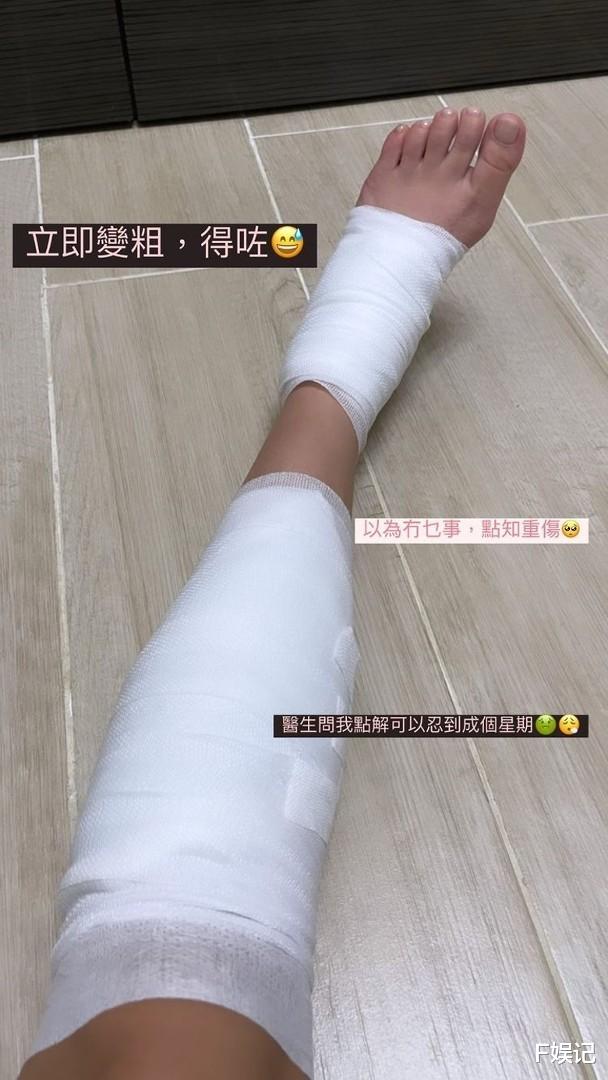 官宣|小腿还受伤了!TVB小花江嘉敏正式官宣分手 男友直接注销社交账号