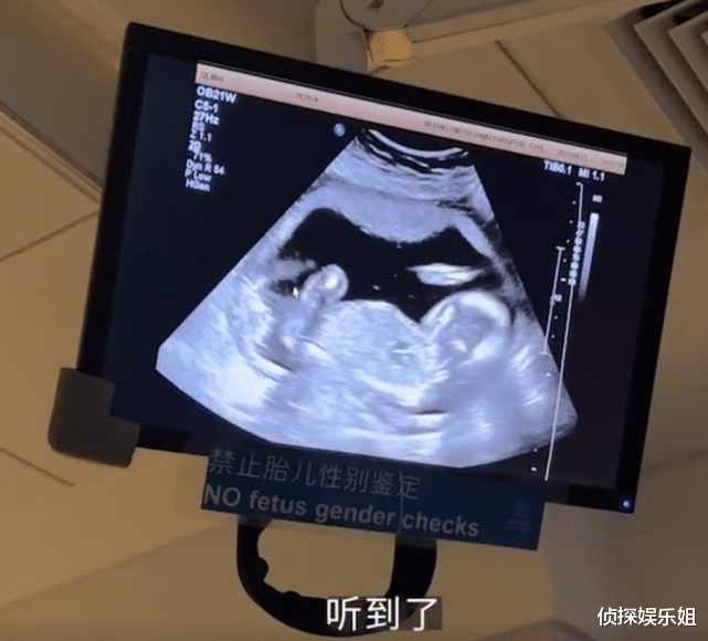 戚薇|戚薇公开二胎vlog，产前体重曝光，lucky初见弟弟超激动