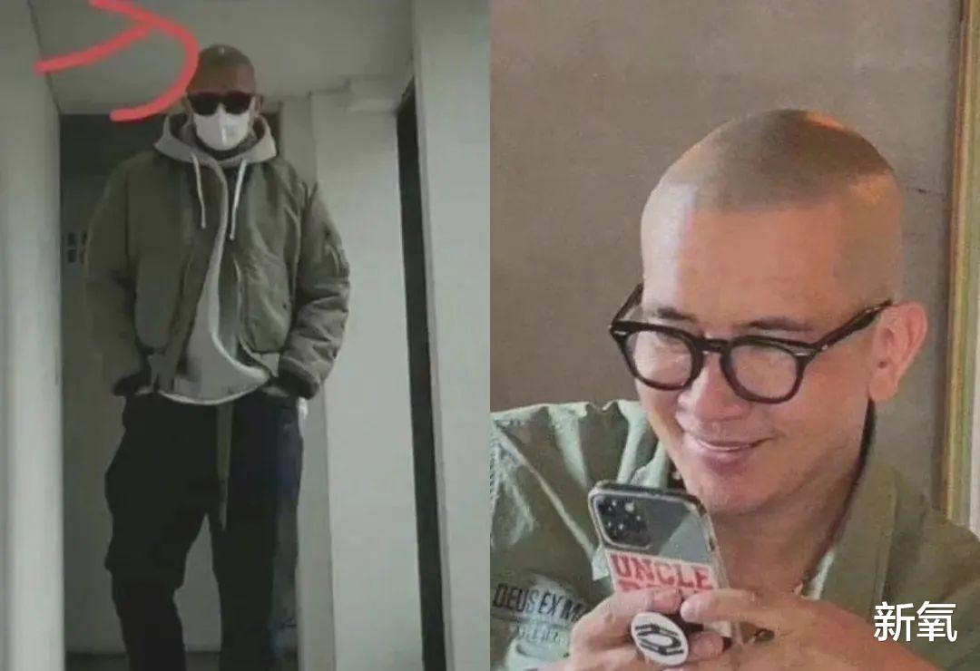 植发 秃不秃？纹发缝到底能不能撬动视觉发量？