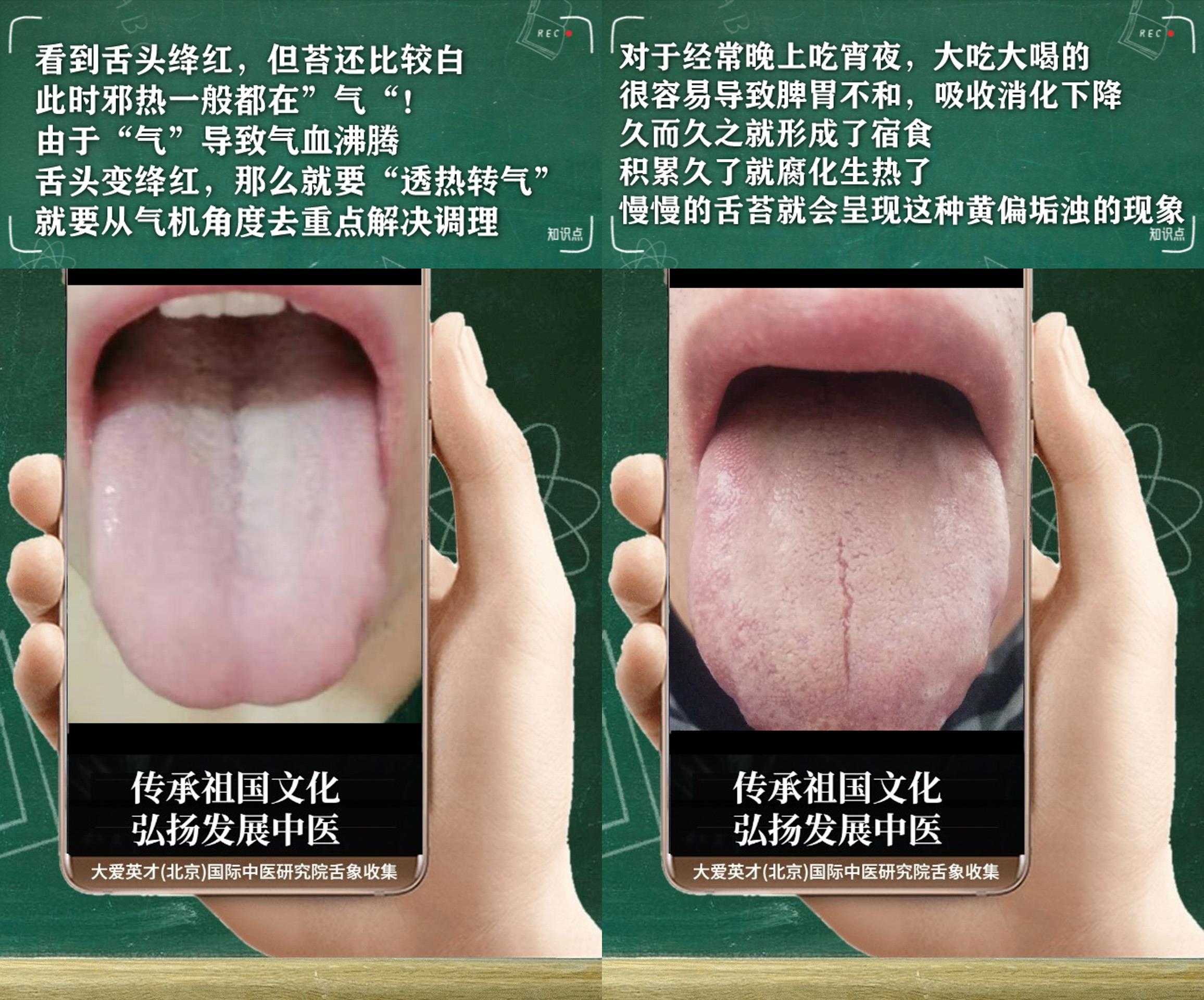 腹泻|中医医案:总是胃痛,胃胀气,食欲不振,排便困难,脾虚肝郁