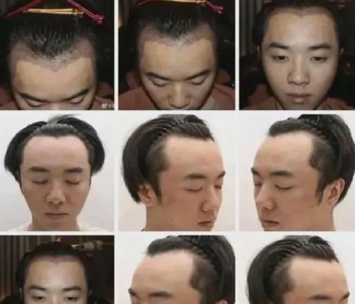 杨幂|容貌有变化,但没承认的6位明星,杨幂脸不方了,金晨鼻孔变小了