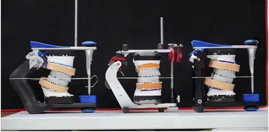 aiot|3D打印在口腔领域上的应用会在未来有明显的体现吗?