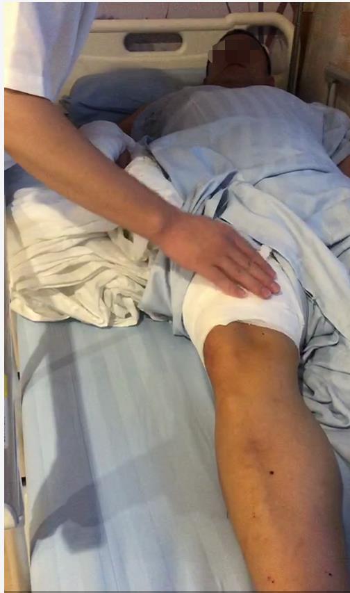 提醒对方将车从消防通道挪移起冲突,男子被追砍5刀又遭铁锨拍头