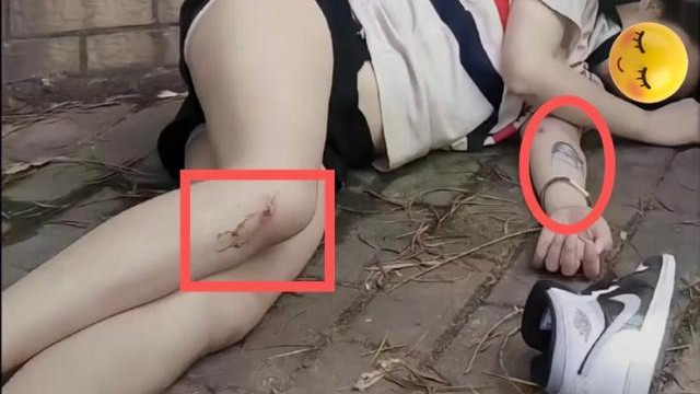 年轻女子醉倒路边，腿上露出新伤疤，网友：庆幸没遇到坏人