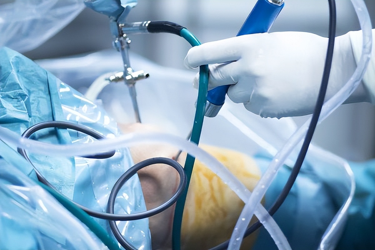 黄芪|瞎坑钱?同样一份医疗器材,为何医院和网上价格却能相差4倍?