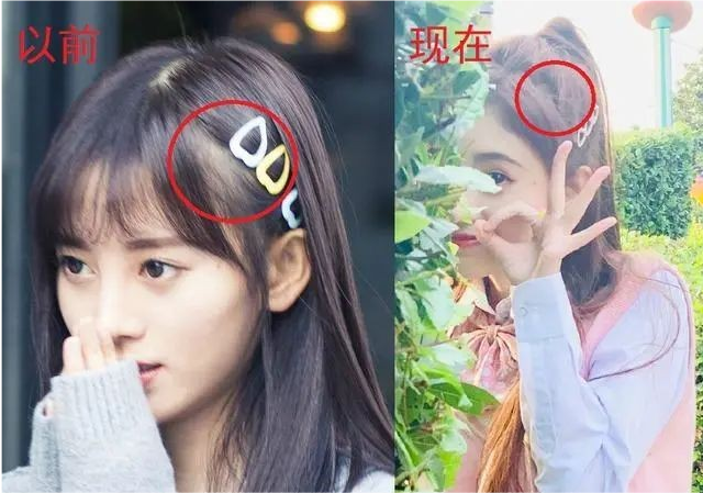 华晨宇|动脸动到“面目全非”的4位明星，华晨宇陈小纭上榜