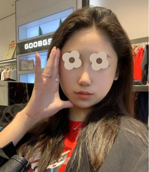护肤 敏感肌脸颊泛红怎么修复