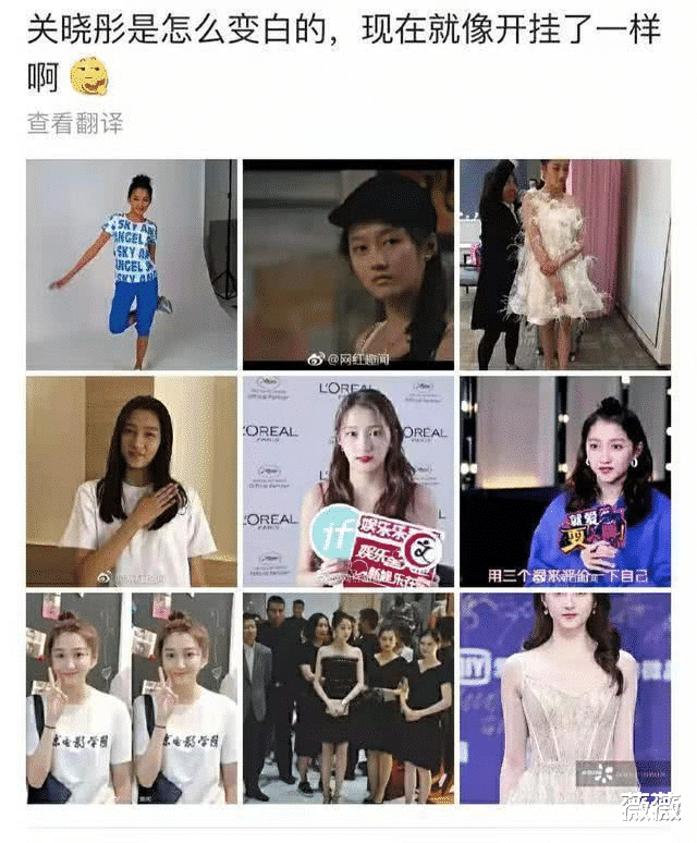 防晒喷雾 娱记曝关晓彤定期去打美白针，因身体受到影响，露面都靠全身擦粉