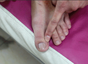 抑郁症|女人更易得抑郁症,推开脚上的一个通道,郁结的肝气一天比一天少