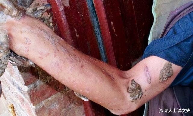 湖南男子手脚长树枝会开花，父母乱投医拜树神，20年后才弄清病因