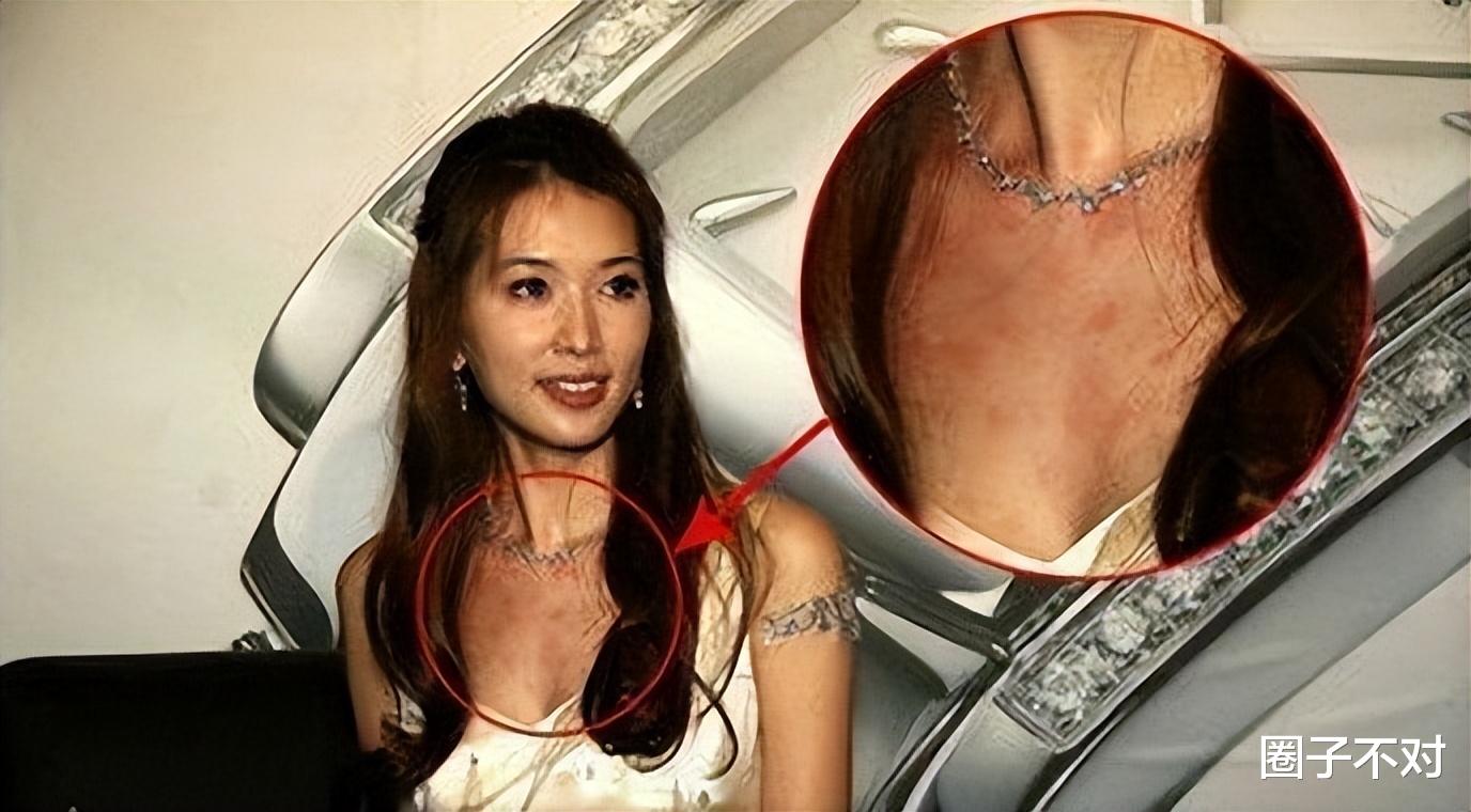 黄瑜娴|口水能过敏，天生没子宫，这6位明星的“隐疾”，有钱也治不好