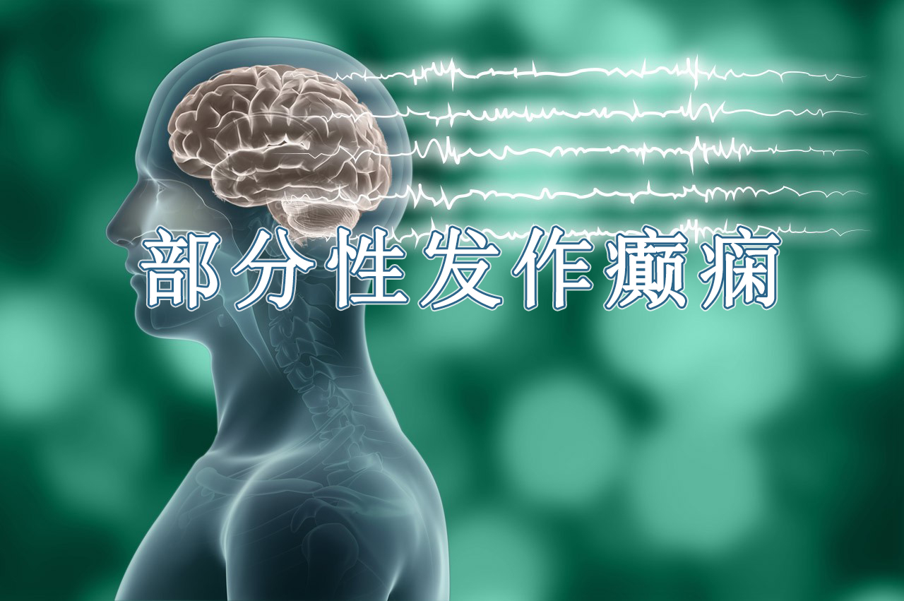 美国食品药品监督管理局|部分性发作癫痫新药！ZONISADE(唑尼沙胺口服混悬剂)获FDA批准