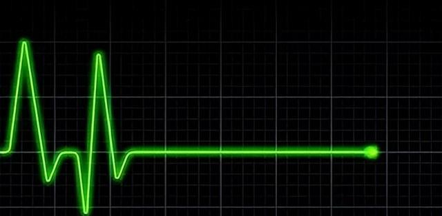 美国科学家复活死猪重要器官,猪“死而复生”!还是原来的猪吗?