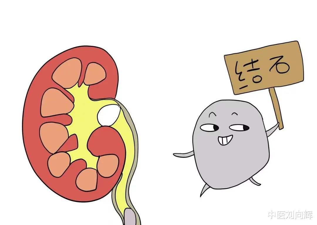 胆结石|肾结石 胆结石 尿路结石 痛不欲生？一剂奇方五金散，清热消石，散结